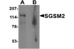 Western blot analysis of SGSM2 in human cerebellum tissue lysate with SGSM2 Antibody  at 1 μg/ml in (A) the absence and (B) the presence of blocking peptide (SGSM2 antibody  (Middle Region))