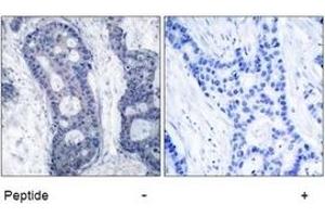 Image no. 1 for anti-Eukaryotic Translation Initiation Factor 4E (EIF4E) (Ser209) antibody (ABIN197473) (EIF4E antibody  (Ser209))