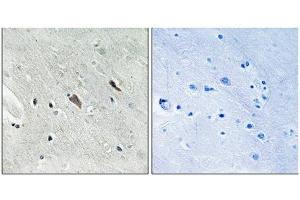 Immunohistochemical analysis of paraffin-embedded human brain tissue using Gab2 (Phospho-Tyr643) antibody (left)or the same antibody preincubated with blocking peptide (right).