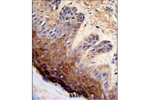 Formalin-fixed and paraffin-embedded human skin with TOP2A Antibody (C-term), which was peroxidase-conjugated to the secondary antibody, followed by DAB staining. (Topoisomerase II alpha antibody  (C-Term))