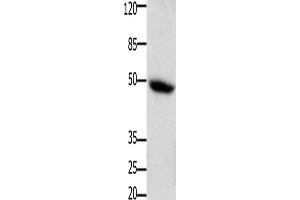 Western Blotting (WB) image for anti-Colony Stimulating Factor 2 Receptor, Alpha, Low-Affinity (Granulocyte-Macrophage) (CSF2RA) antibody (ABIN2426009) (CSF2RA antibody)