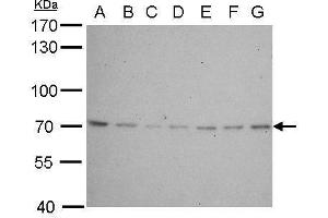 Western Blotting (WB) image for anti-Lamin B2 (LMNB2) antibody (ABIN2856712)