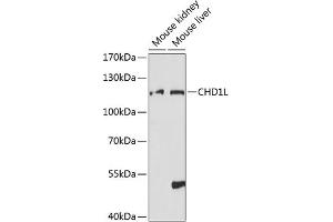 Western blot analysis of extracts of various cell lines, using CHD1L antibody (ABIN7266362) at 1:1000 dilution. (CHD1L antibody  (AA 320-570))
