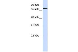 Western Blotting (WB) image for anti-UDP-N-Acetyl-alpha-D-Galactosamine:polypeptide N-Acetylgalactosaminyltransferase 6 (GalNAc-T6) (GALNT6) antibody (ABIN2459055) (GALNT6 antibody)