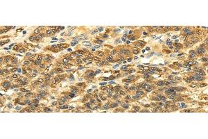 SLC6A19 antibody