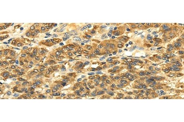 SLC6A19 antibody
