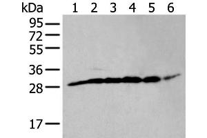 Western blot analysis of PC-3 cell mouse skeletal muscle tissue mouse brain tissue human heart tissue Hela and HEPG2 cell lysates using ETFB Polyclonal Antibody at dilution of 1:400 (ETFB antibody)