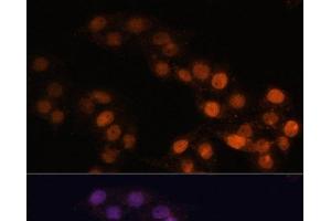 Immunofluorescence analysis of HeLa cells using WT1 Polyclonal Antibody at dilution of 1:100. (WT1 antibody)