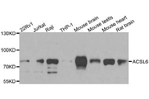 Western blot analysis of extracts of various cell lines, using ACSL6 antibody. (ACSL6 antibody  (AA 383-622))