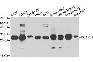 Western blot analysis of extracts of various cell lines, using BCAP31 antibody. (BCAP31 antibody  (AA 127-246))
