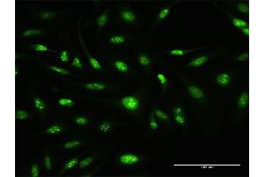 Immunofluorescence of purified MaxPab antibody to ATOH7 on HeLa cell.