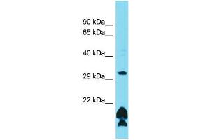 Host: Rabbit Target Name: OR51B5 Sample Type: HCT15 Whole Cell lysates Antibody Dilution: 1. (OR51B5 antibody  (C-Term))
