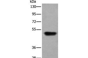 Western blot analysis of Human fetal liver tissue lysate using HNRNPH2 Polyclonal Antibody at dilution of 1:400 (HNRNPH2 antibody)