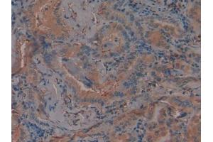 Used in DAB staining on fromalin fixed paraffin-embedded Kidney tissue (PAI1 antibody  (AA 25-402))
