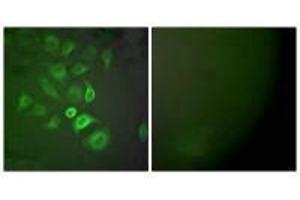 Immunofluorescence analysis of A549 cells, using S100 A1 antibody. (S1A1 antibody)