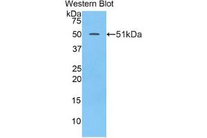 Western blot analysis of the recombinant protein. (LAMC2 antibody  (AA 972-1191))