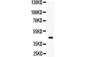 Western Blotting (WB) image for anti-Wingless-Type MMTV Integration Site Family, Member 2B (WNT2B) (AA 87-112), (N-Term) antibody (ABIN3042337) (WNT2B antibody  (N-Term))