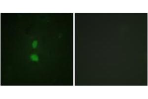 Immunofluorescence analysis of HuvEc cells, using SNAI1 (Phospho-Ser246) Antibody. (SNAIL antibody  (pSer246))