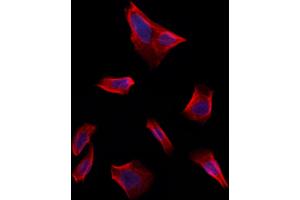 ABIN6261694 and ABIN6273243 staining Hela by IF/ICC. (FBXO22 antibody  (Internal Region))