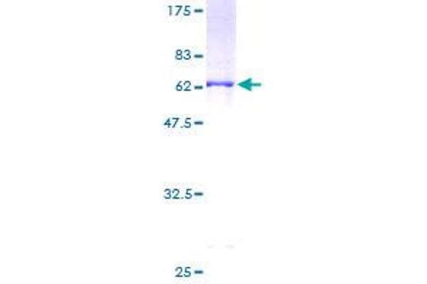 PHYH Protein (AA 1-338) (GST tag)