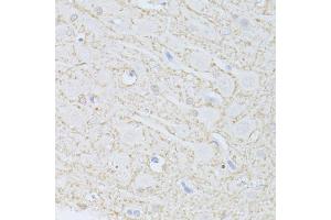 Immunohistochemistry of paraffin-embedded rat brain using PHGDH antibody (ABIN5998506) at dilution of 1/100 (40x lens).