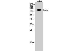 Western Blotting (WB) image for anti-Ezrin (EZR) (Tyr315) antibody (ABIN3184570) (Ezrin antibody  (Tyr315))