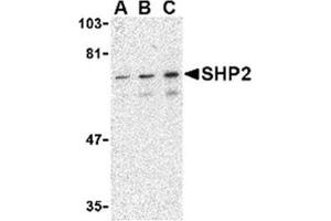 Image no. 1 for anti-Protein tyrosine Phosphatase, Non-Receptor Type 11 (PTPN11) (C-Term) antibody (ABIN318781) (PTPN11 antibody  (C-Term))
