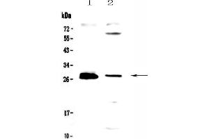 Western blot analysis of TWEAK using anti-TWEAK antibody .