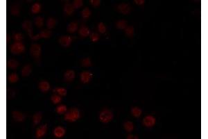 ABIN6266827 staining HeLa by IF/ICC. (DKC1 antibody  (Internal Region))