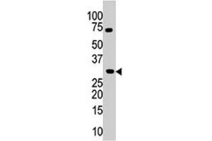 The PIM3 polyclonal antibody  is used in Western blot to detect PIM3 in mouse kidney tissue lysate. (PIM3 antibody  (C-Term))