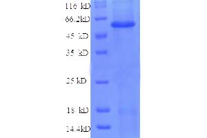 SDS-PAGE (SDS) image for Angiopoietin 2 (ANGPT2) (AA 19-485), (partial) protein (His tag) (ABIN5712419) (Angiopoietin 2 Protein (ANGPT2) (AA 19-485, partial) (His tag))