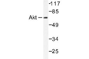 Image no. 1 for anti-V-Akt Murine Thymoma Viral Oncogene Homolog 1 (AKT1) antibody (ABIN265302) (AKT1 antibody)