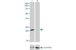 Western blot analysis of GUCA1A over-expressed 293 cell line, cotransfected with GUCA1A Validated Chimera RNAi (Lane 2) or non-transfected control (Lane 1). (GCAP1 antibody  (AA 1-93))