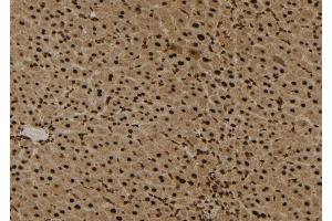 ABIN6272294 at 1/100 staining Mouse liver tissue by IHC-P. (EPS8-Like 3 antibody)