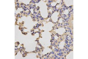 Immunohistochemistry of paraffin-embedded mouse lung using PRKACB antibody (ABIN5973065) at dilution of 1/200 (40x lens). (PRKACB antibody)