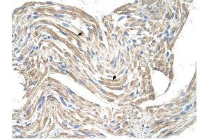 CKMT2 antibody was used for immunohistochemistry at a concentration of 4-8 ug/ml to stain Skeletal muscle cells (arrows) in Human Muscle. (CKMT2 antibody)