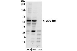 Western Blotting (WB) image for anti-LAP2 beta gamma/tmpo (AA 350-400) antibody (ABIN7455057) (LAP2 beta gamma/tmpo (AA 350-400) antibody)