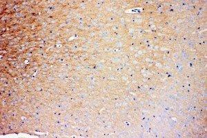 Anti-Prion protein PrP antibody, IHC(P) IHC(P): Rat Brain Tissue (PRNP antibody  (Middle Region))