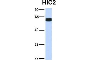 Host:  Rabbit  Target Name:  HIC2  Sample Type:  Human Fetal Brain  Antibody Dilution:  1. (HIC2 antibody  (Middle Region))