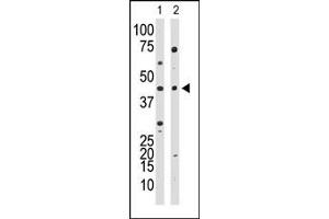 Western Blotting (WB) image for anti-YY1 Transcription Factor (YY1) (Middle Region) antibody (ABIN357757)