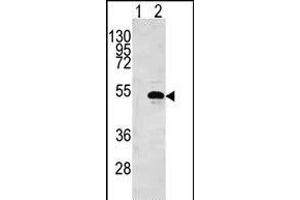 Western blot analysis of CKB (arrow) using rabbit polyclonal CKB Antibody (N5) (ABIN391073 and ABIN2841220). (CKB antibody  (N-Term))