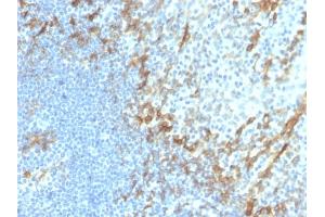 Formalin-fixed, paraffin-embedded human tonsil stained with Podoplanin Recombinant Rabbit Monoclonal Antibody (PDPN/4009R). (Recombinant Podoplanin antibody  (AA 1-100))