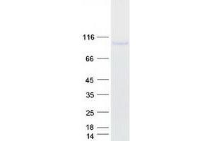 Western Blotting (WB) image for Toll-Like Receptor 4 (TLR4) (Transcript Variant 1) protein (Myc-DYKDDDDK Tag) (ABIN2713609)