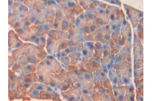 DAB staining on IHC-P; Samples: Mouse Pancreas Tissue (MYLK4 antibody  (AA 96-353))