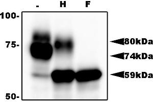 Western Blotting (WB) image for anti-HHV6 gQ1 (AA 3-422) antibody (ABIN2452012)
