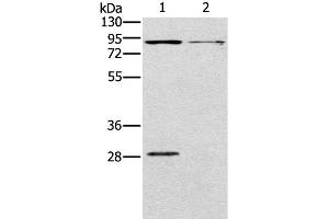 Western Blot analysis of Mouse kidney and brain tissue using CNGA3 Polyclonal Antibody at dilution of 1:500 (CNGA3 antibody)
