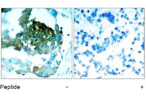 Image no. 1 for anti-Protein Kinase C, theta (PRKCQ) (AA 693-697) antibody (ABIN197401) (PKC theta antibody  (AA 693-697))