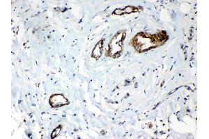 IHC analysis of HSPB8/Hsp22 using anti- HSPB8/Hsp22 antibody .