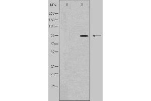Western blot analysis of extracts from HepG2 cells, using SLC27A5 antibody.