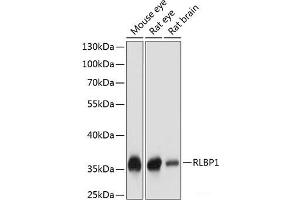 Western blot analysis of extracts of various cell lines using RLBP1 Polyclonal Antibody at dilution of 1:1000. (RLBP1 antibody)